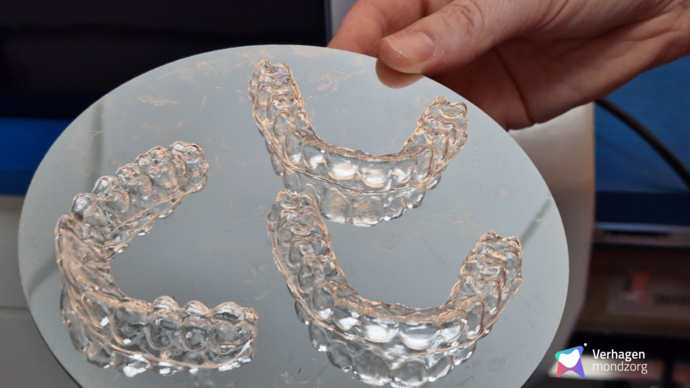 Graphy Aligners met watermerk 9 